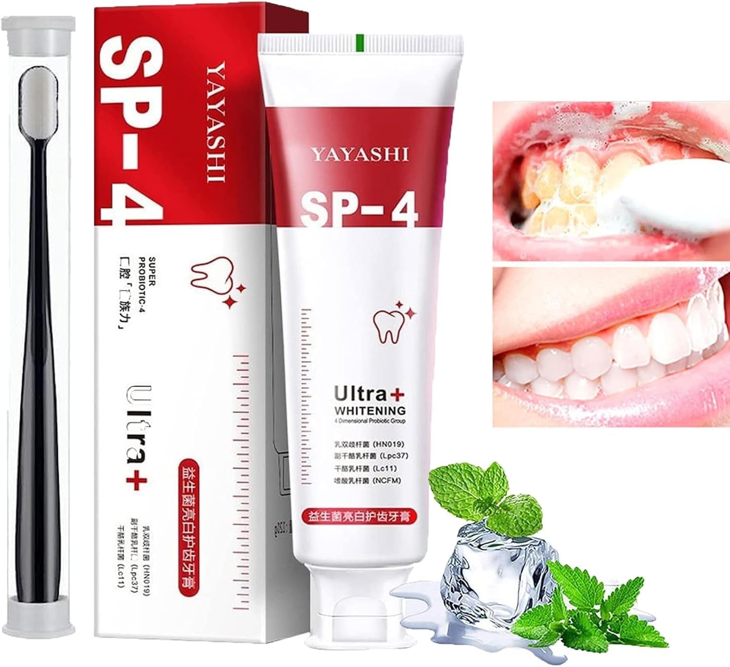 Original Probiotic Ultra SP4 Whitening Toothpaste | Removes Stains, Freshens Breath & Strengthens Enamel
