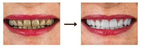 Original Probiotic Ultra SP4 Whitening Toothpaste | Removes Stains, Freshens Breath & Strengthens Enamel