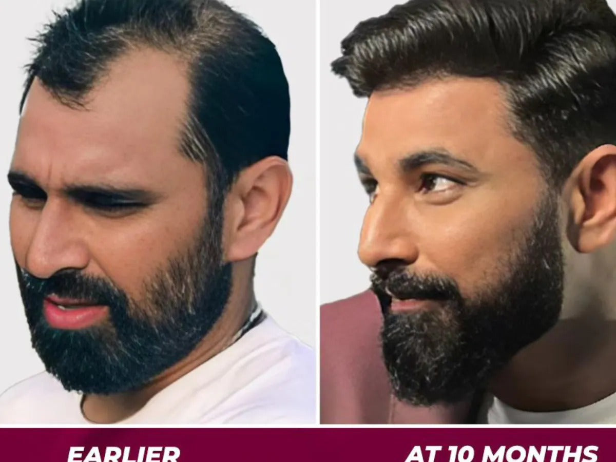 Jamaalgota™ आयुर्वेदिक कपाल बढाउने पाउडर – Premium Quality Hair Growth Powder