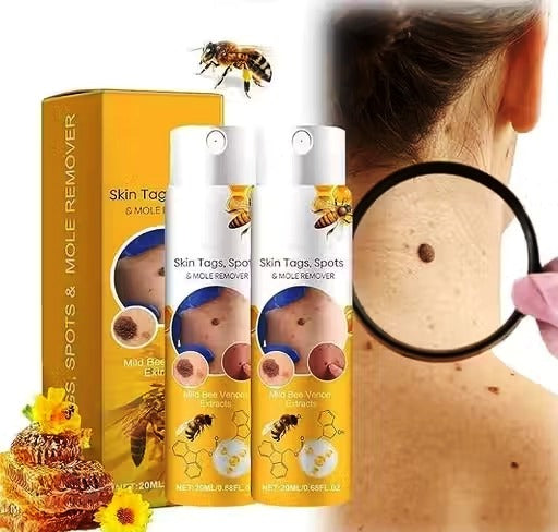 Bee Venom Skin Tag Recede Removal Spray – Kin Tag, Wart & Masu हटाउने प्राकृतिक स्प्रे (600ml)